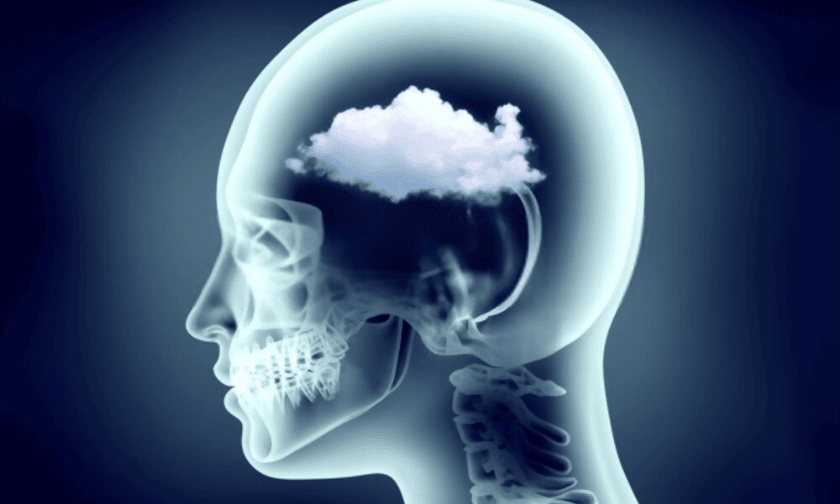 All You Need To Know About Brain Fog